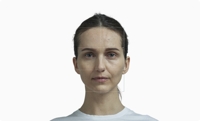 Front-facing portrait with facial thirds measurement grid overlay for symmetry and proportion analysis