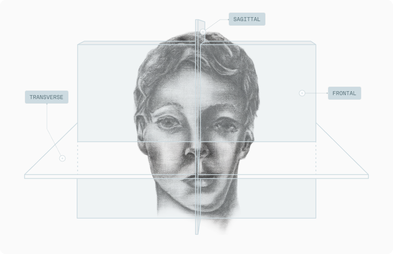 Medical illustration of hemifacial microsomia showing craniofacial asymmetry with reference planes