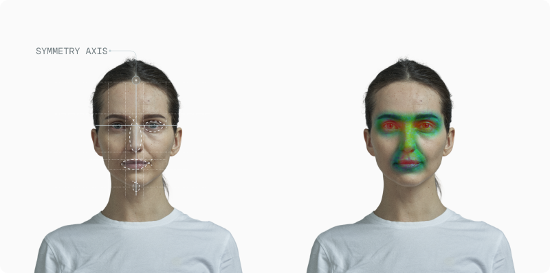 Standardized portrait with facial asymmetry measurement overlay showing percentage deviations