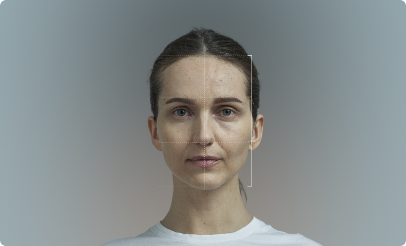 Facial thirds and midpoint reference line