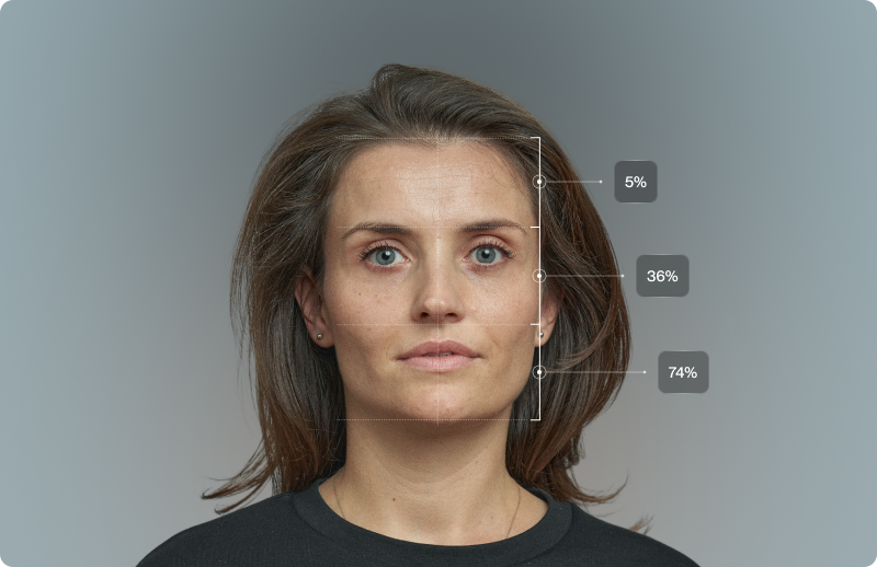 Asymmetries distribution 