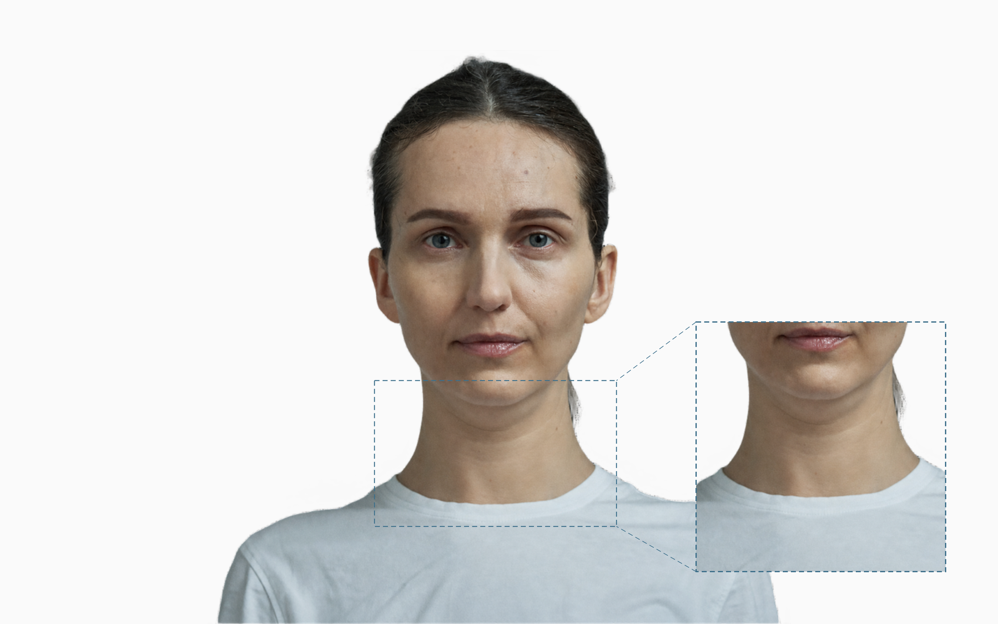 Woman's chin and neck with a magnified callout showing a double chin