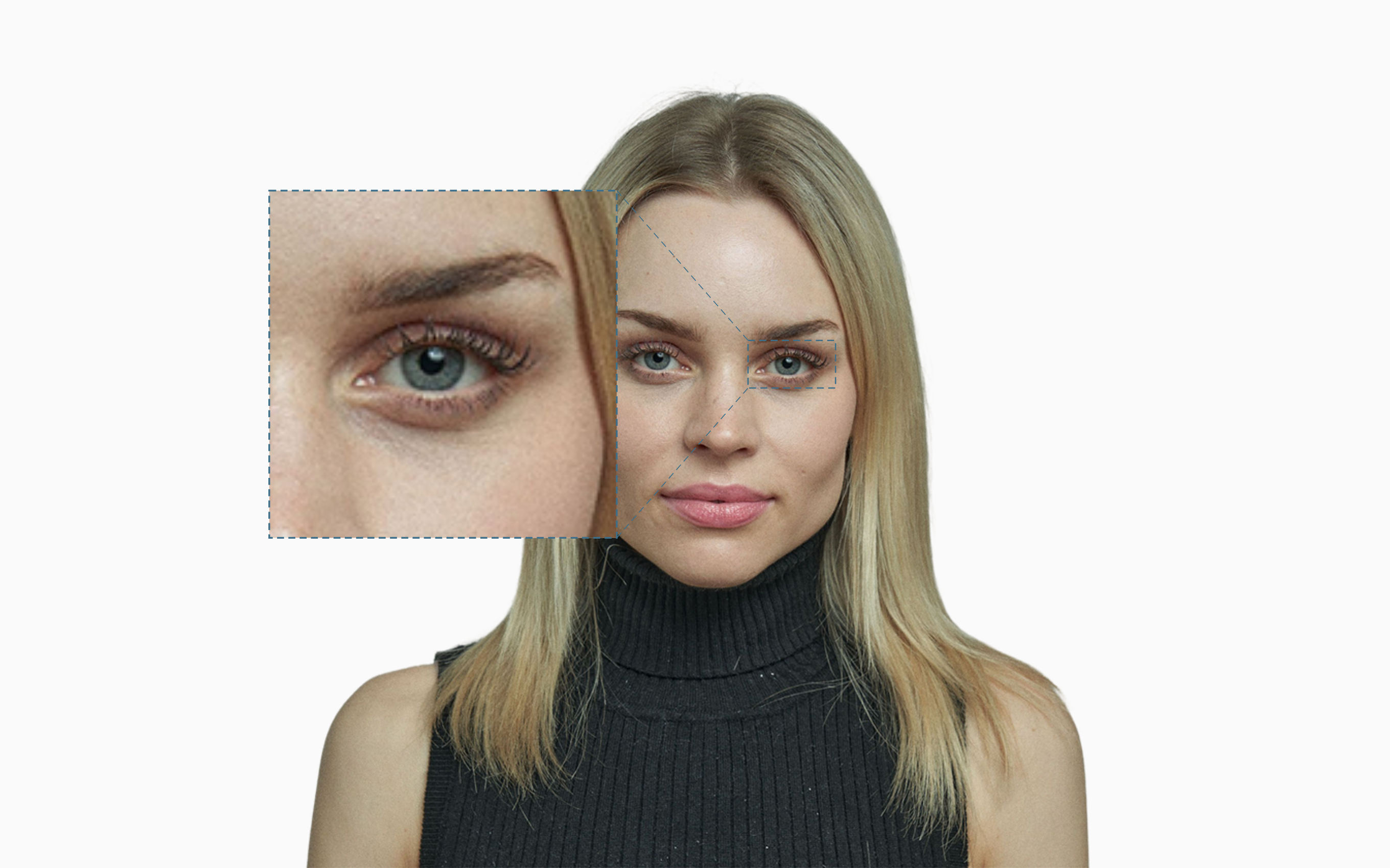 Under-eye dark-circle region on a frontal face Under-eye dark-circle region on a frontal face