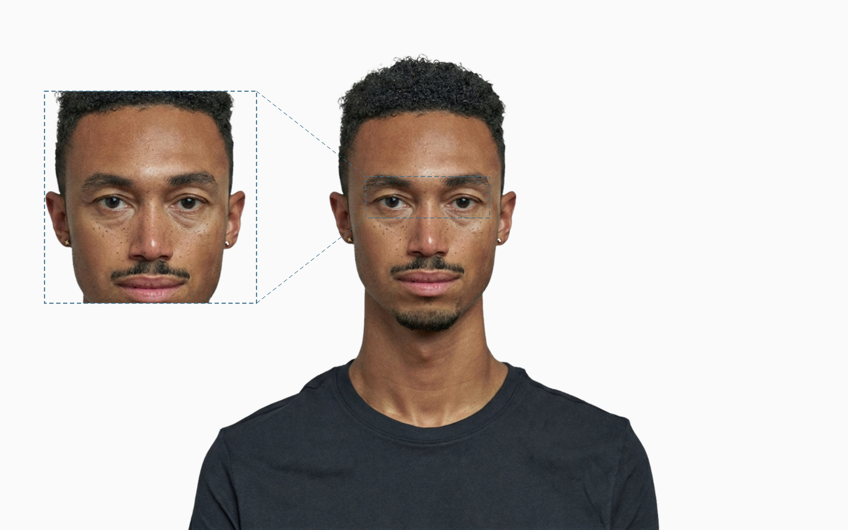 Hooded eyes on a frontal face, with the upper-eyelid area shown in an adjacent zoom panel Hooded eyes on a frontal face, with the upper-eyelid area shown in an adjacent zoom panel