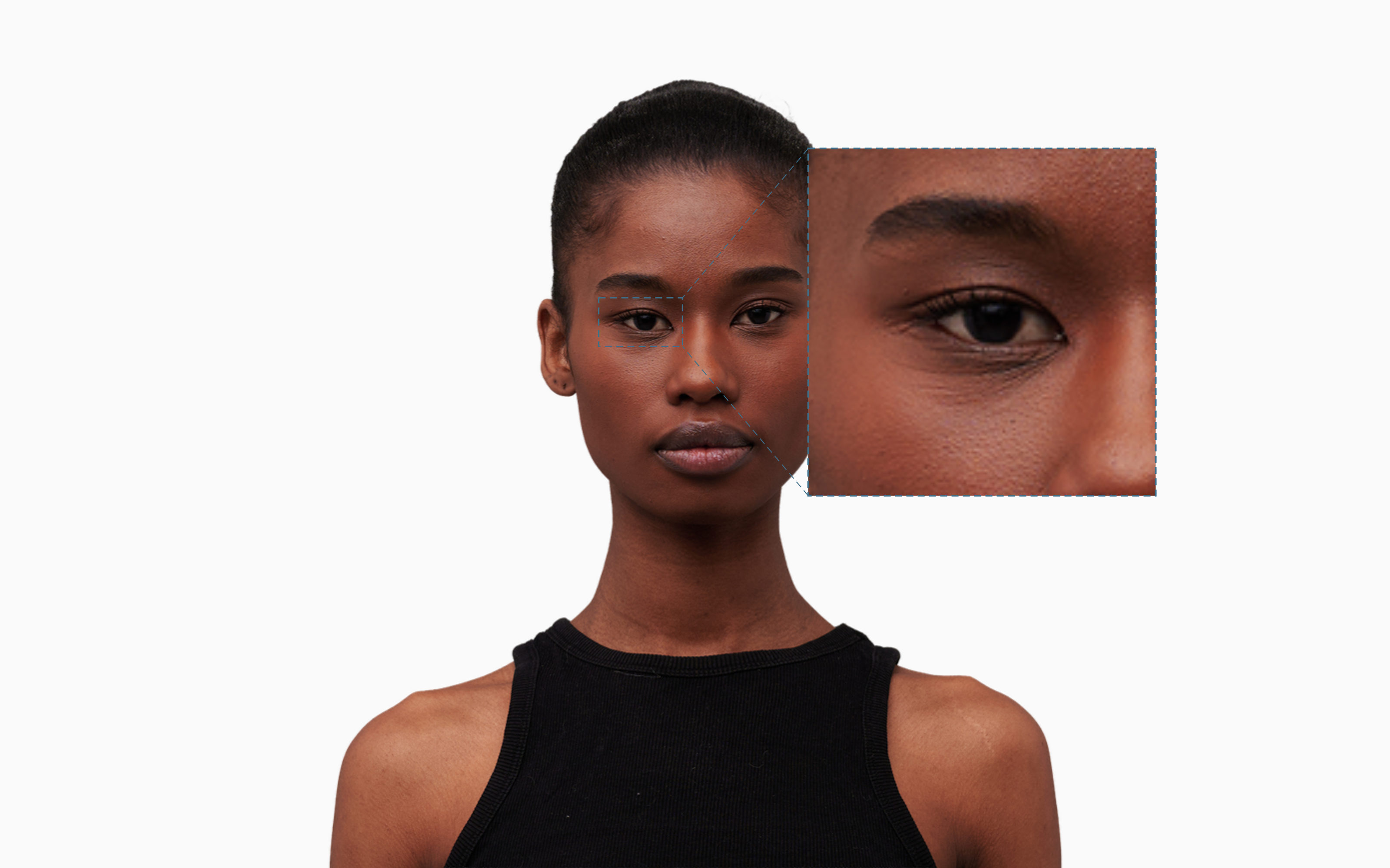 Female frontal portrait with under-eye region highlighted by a dashed zoom callout