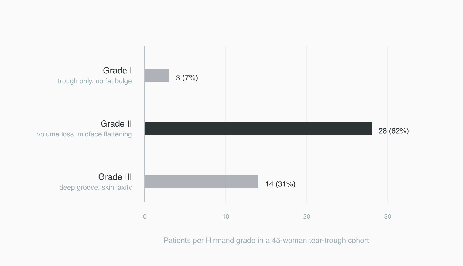 Hirmand grade distribution of tear troughs in 45 patients, Grade II most common Hirmand grade distribution of tear troughs in 45 patients, Grade II most common
