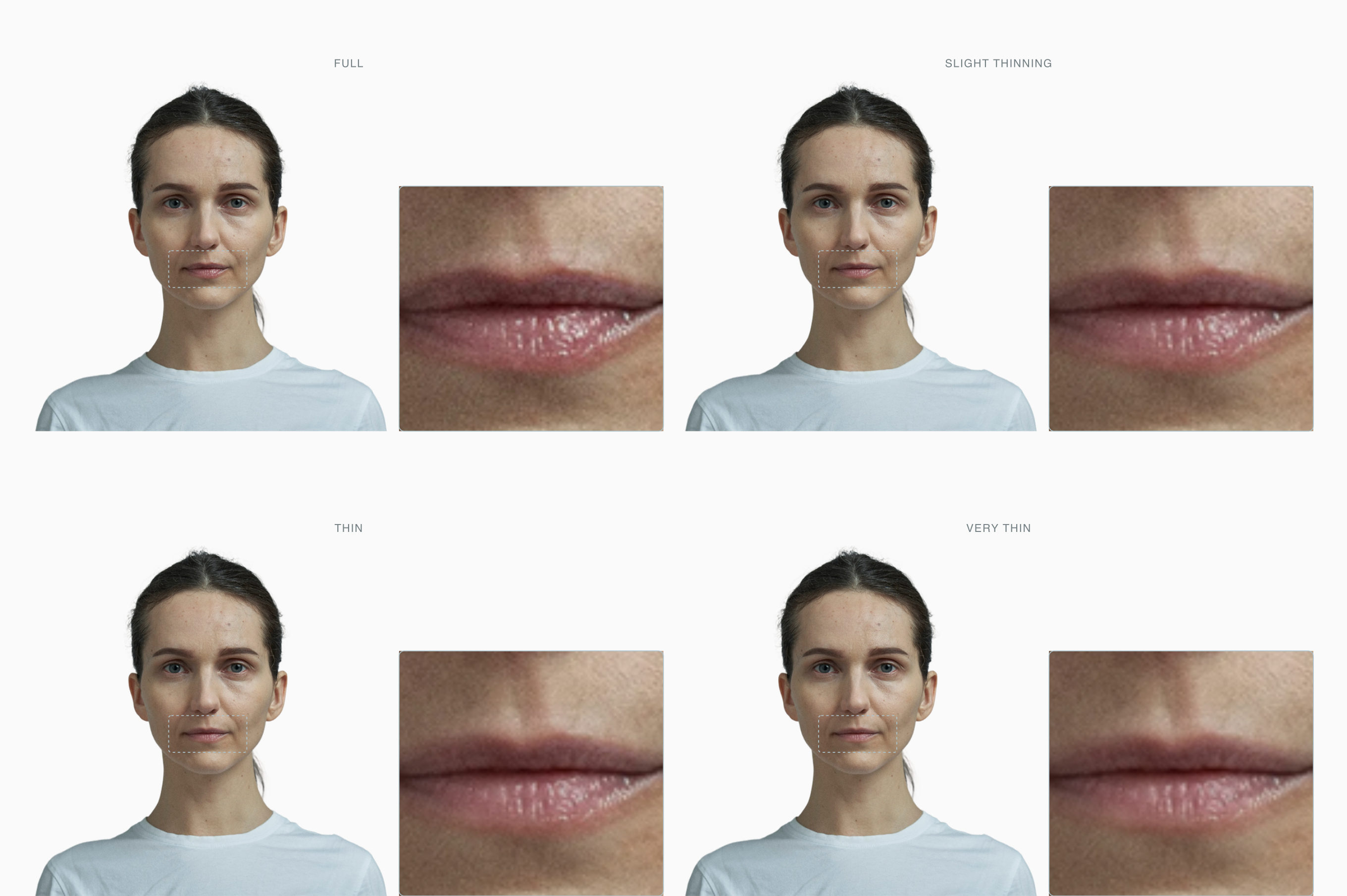 Lips thinning across four stages, full to very thin, on one unchanged face Lips thinning across four stages, full to very thin, on one unchanged face