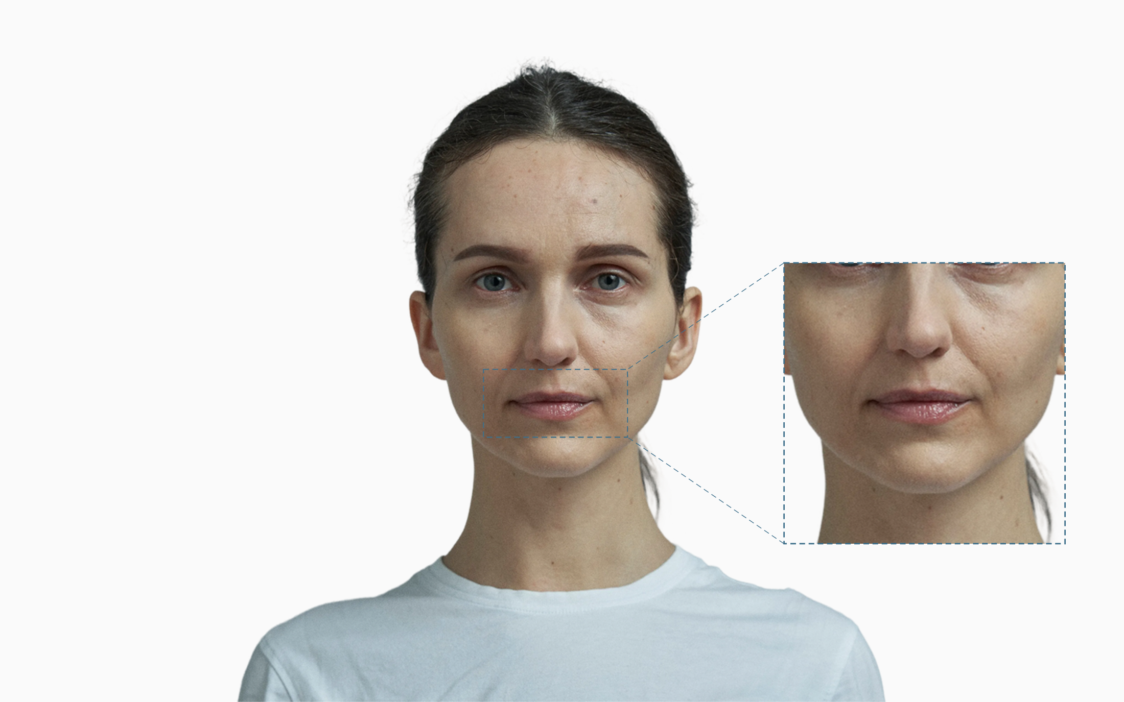 Thin lips on a front-facing portrait, with a dashed callout magnifying the mouth
