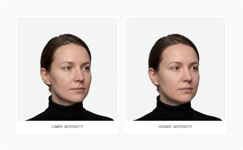 Two three-quarter portraits of a woman labelled lower adiposity and higher adiposity