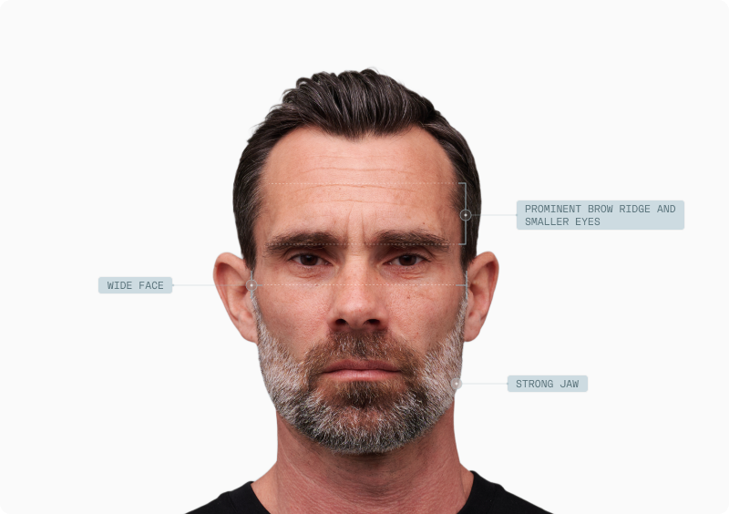 Facial Dimorphism article — figure 10 (replace alt in CMS)