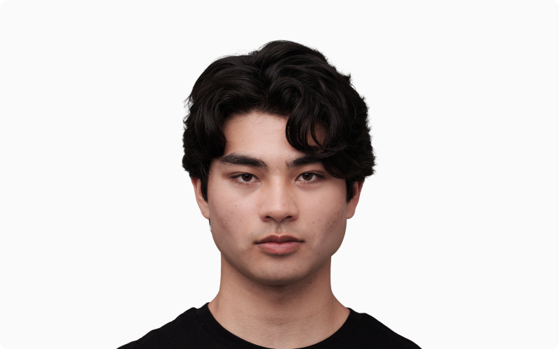 Facial Neoteny article — figure 3 (refine in CMS if needed)