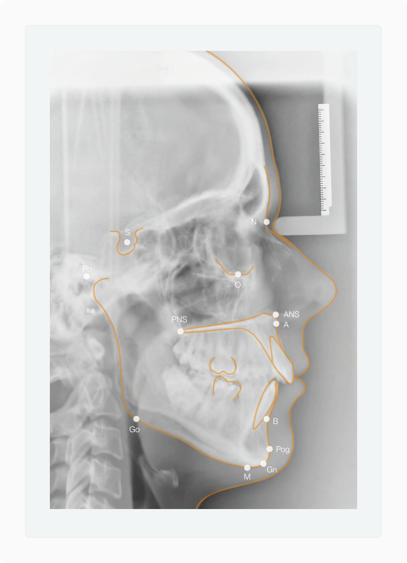 Facial Proportionality article — figure 11 (refine in CMS if needed)