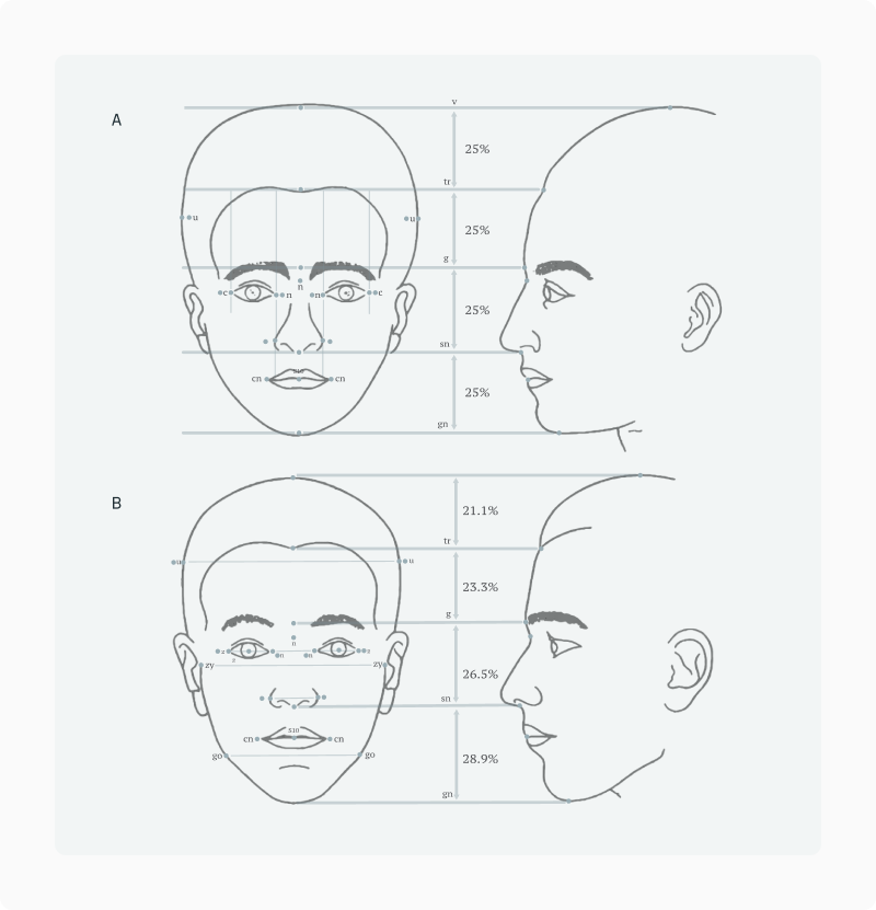 Facial Proportionality article — figure 14 (refine in CMS if needed)