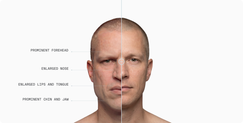 Facial Proportionality article — figure 5 (refine in CMS if needed)