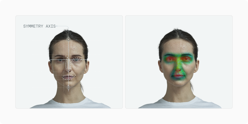 Standardized portrait with facial asymmetry measurement overlay showing percentage deviations