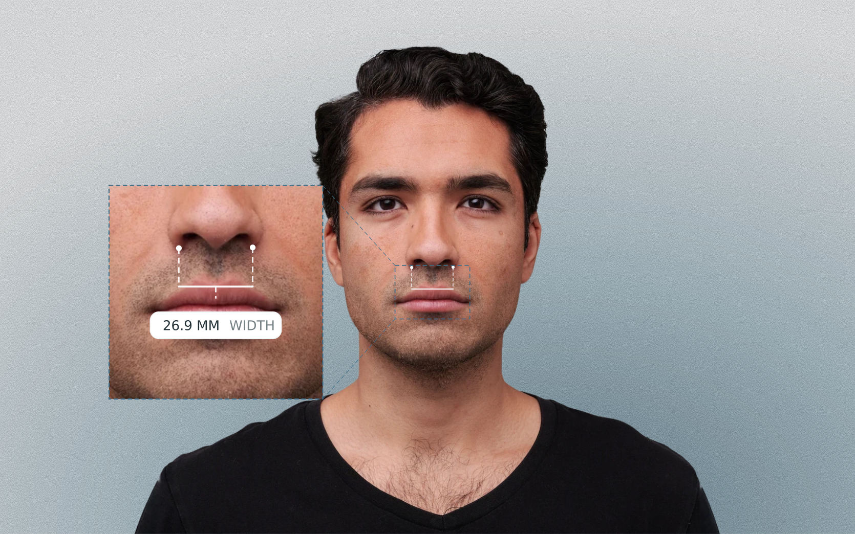 Alar width measured on a male front-facing portrait Alar width measured on a male front-facing portrait