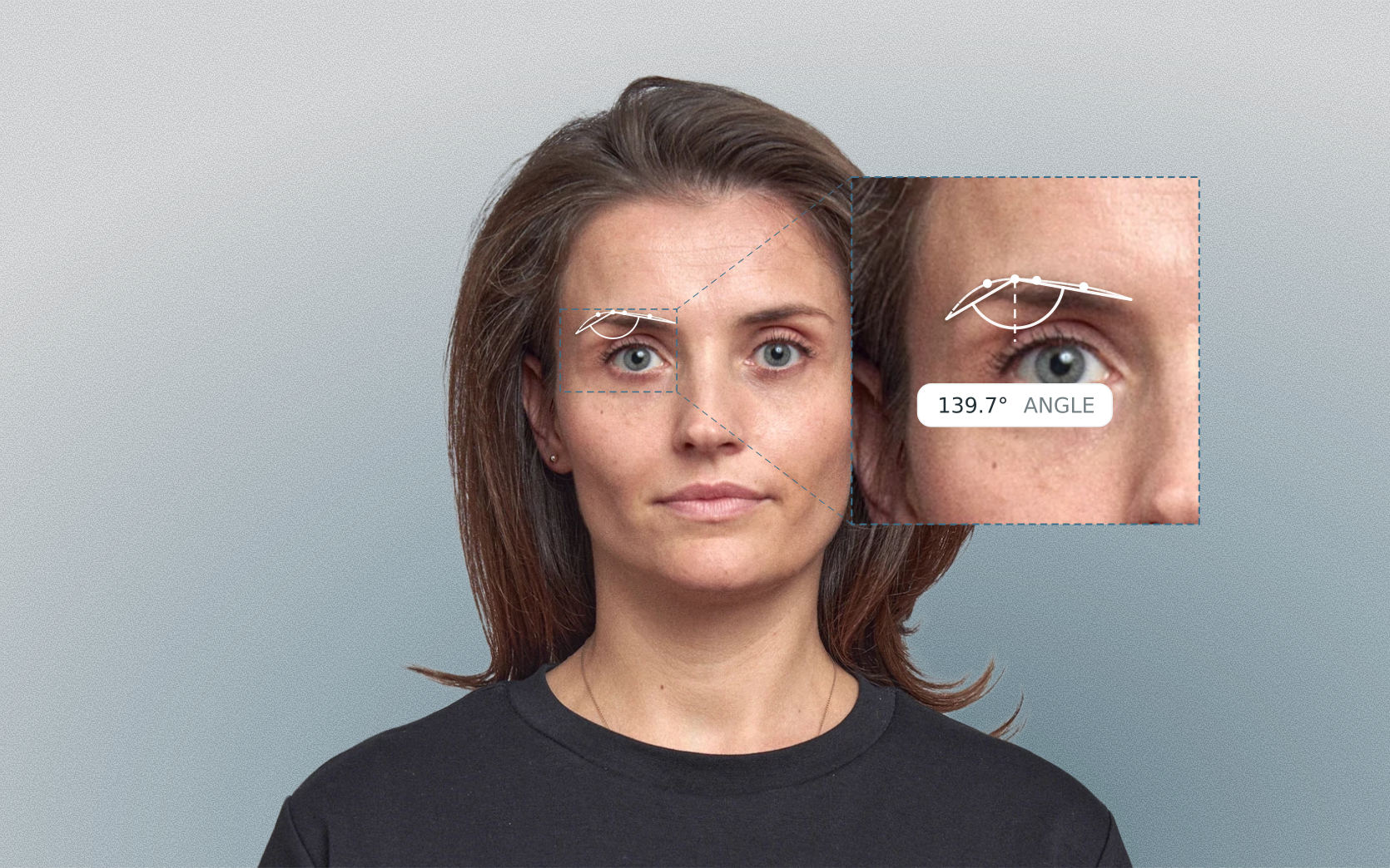 Brow apex angle measured on a female front-facing portrait Brow apex angle measured on a female front-facing portrait