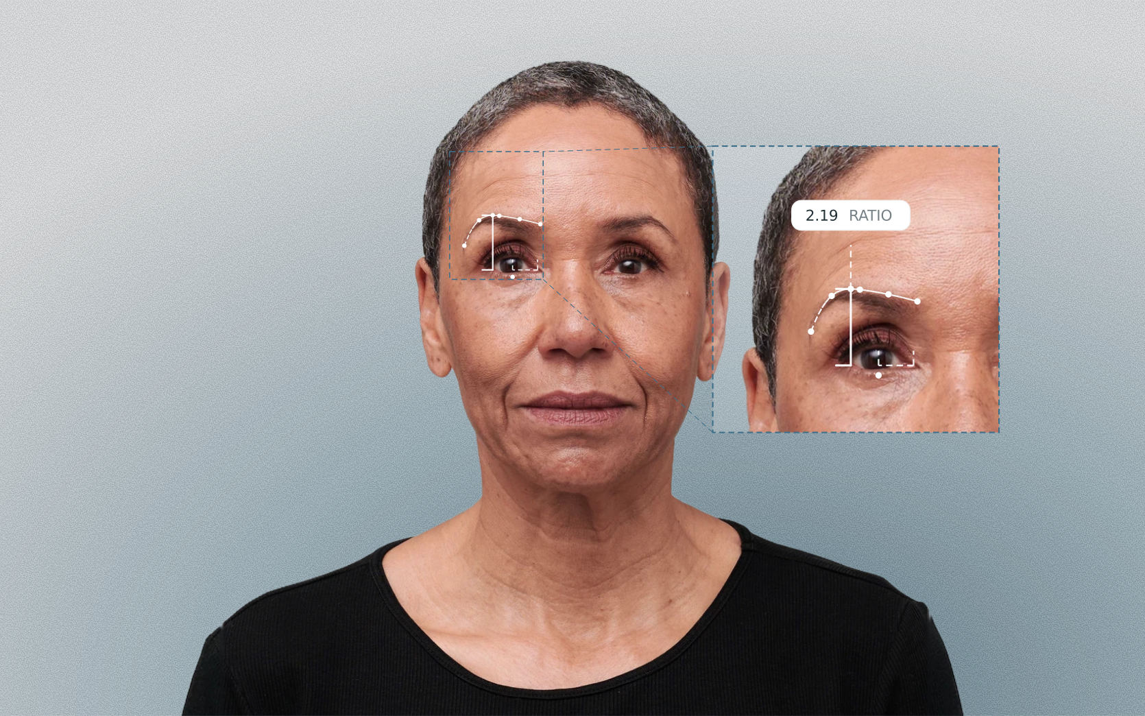 Brow elevation measured on a female front-facing portrait