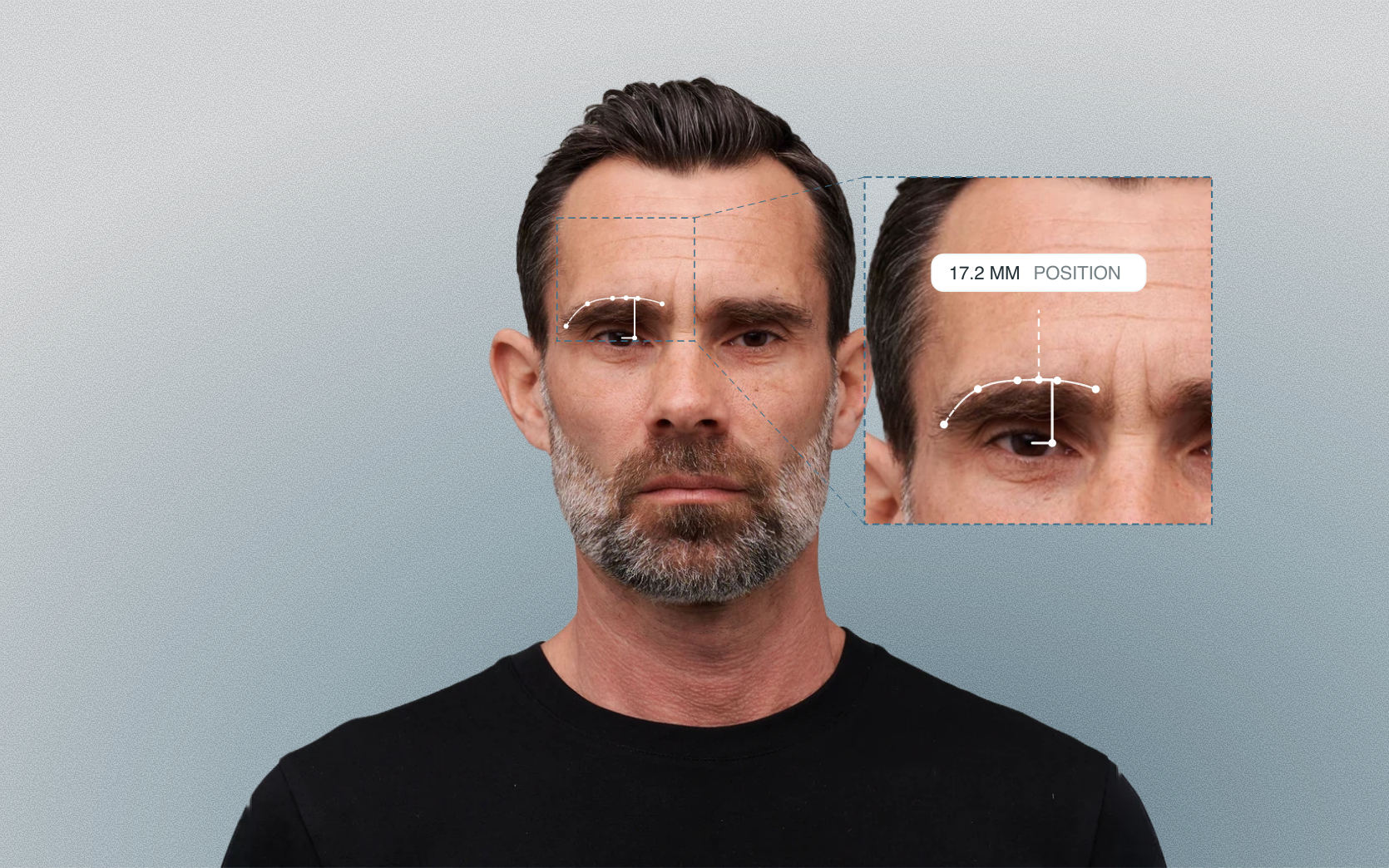 Brow position measured on a male front-facing portrait Brow position measured on a male front-facing portrait