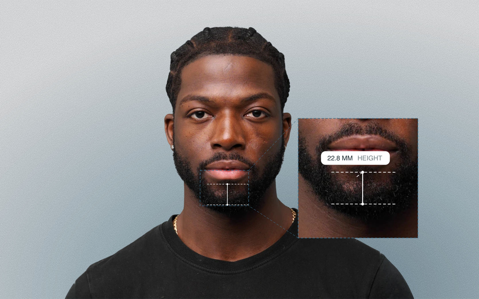 Chin height measured on a male front-facing portrait Chin height measured on a male front-facing portrait