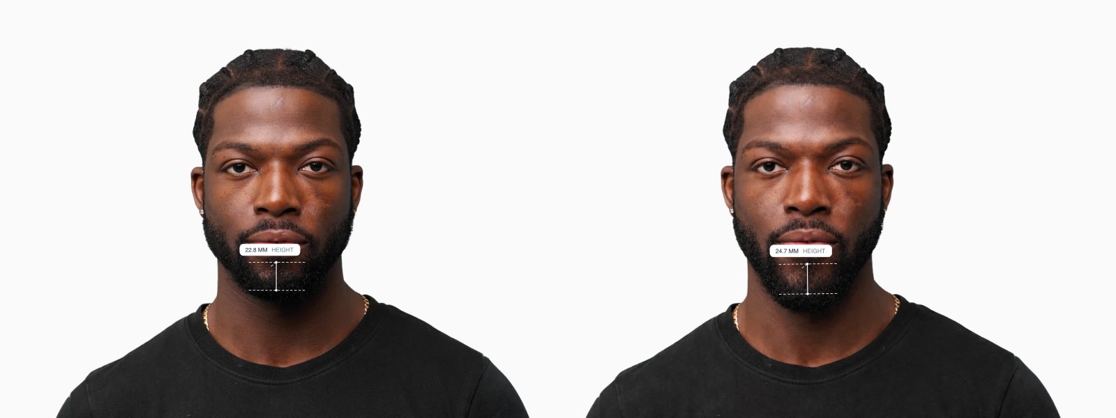 Two copies of the same male front-facing face with the chin height drawn on each, the right one with a taller chin Two copies of the same male front-facing face with the chin height drawn on each, the right one with a taller chin