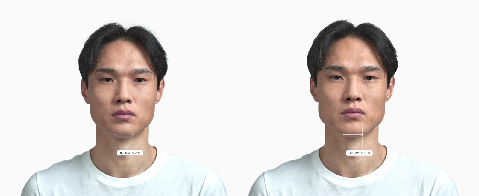 Two copies of the same male front-facing face with the chin width drawn on each, the right one with a broader chin Two copies of the same male front-facing face with the chin width drawn on each, the right one with a broader chin