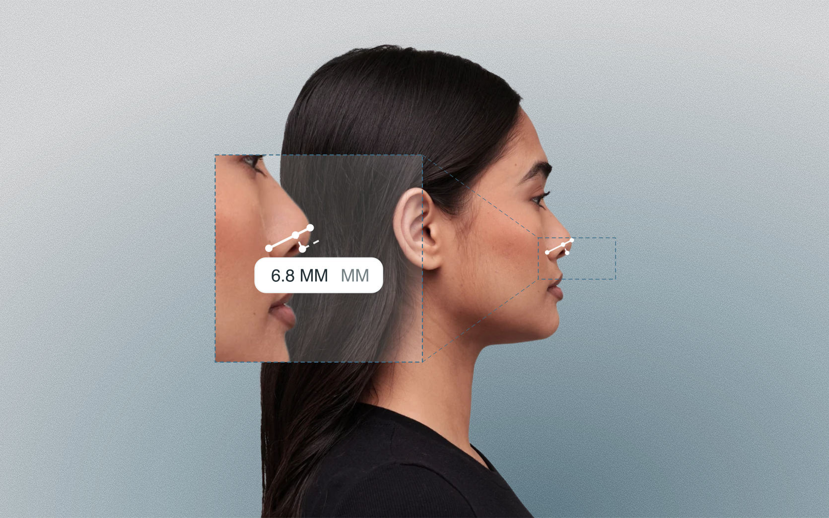 Columella show measured on a female side-profile portrait Columella show measured on a female side-profile portrait