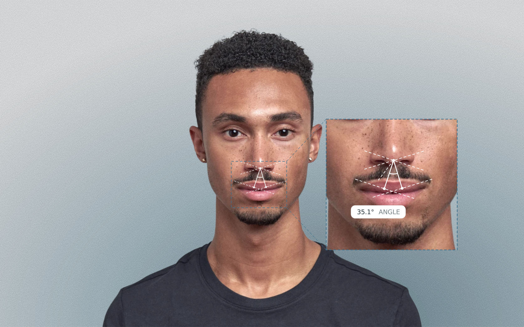 Cupid's bow angle measured on a male front-facing portrait Cupid's bow angle measured on a male front-facing portrait