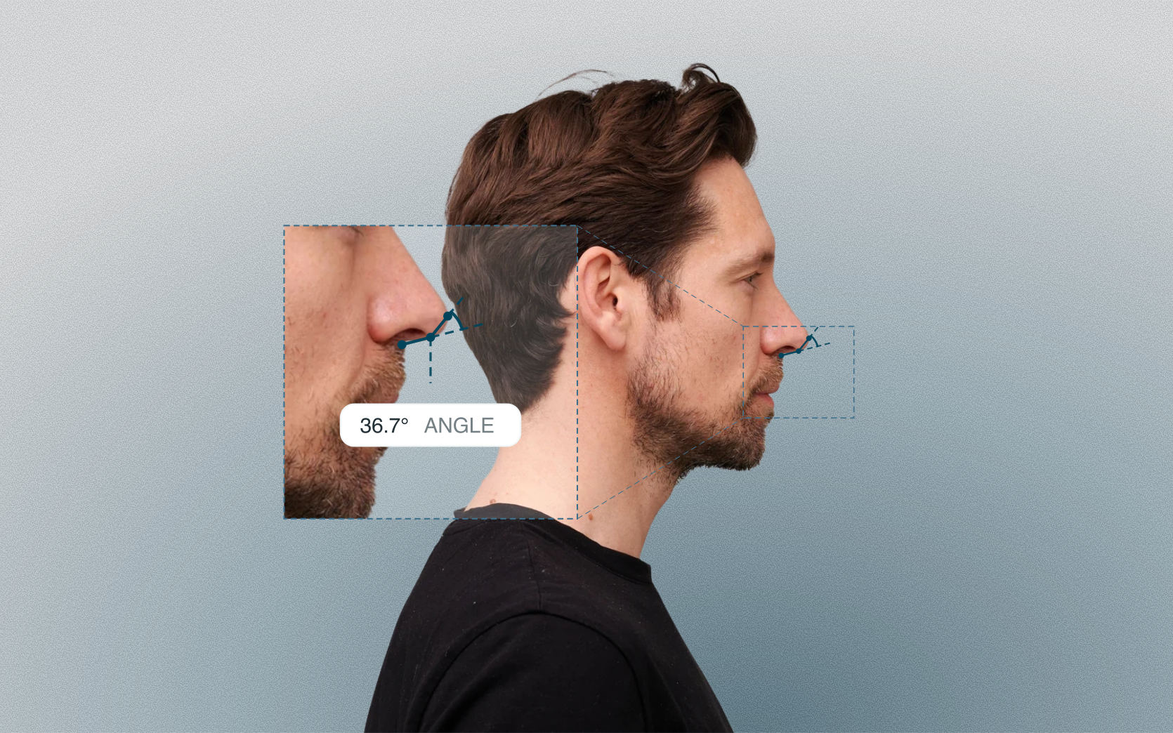 Double break angle measured on a male side-profile portrait Double break angle measured on a male side-profile portrait