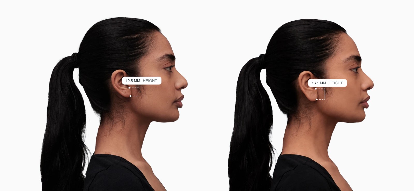Two copies of the same female side-profile face with the earlobe height drawn on each, the right one with larger earlobes