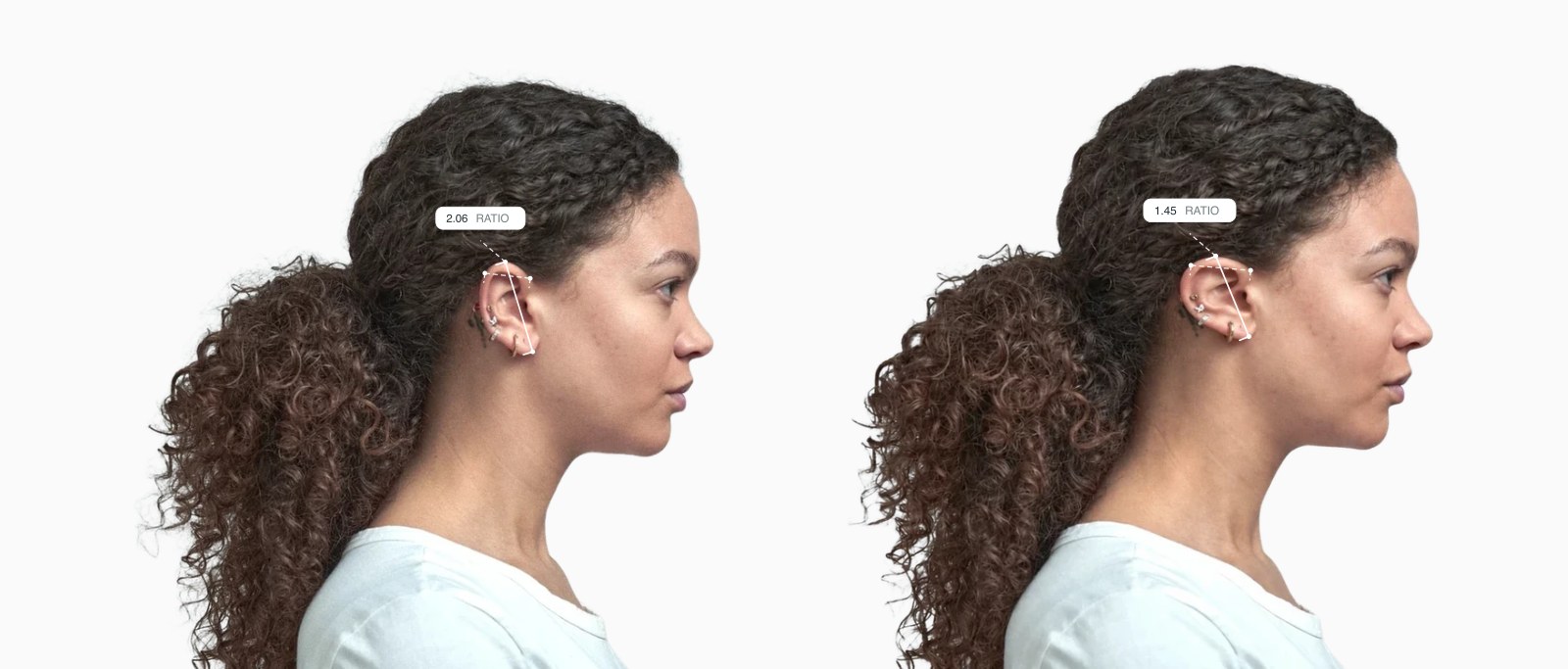Two copies of the same female side-profile face with the ear length-to-breadth ratio drawn on each, the right one with a reshaped ear