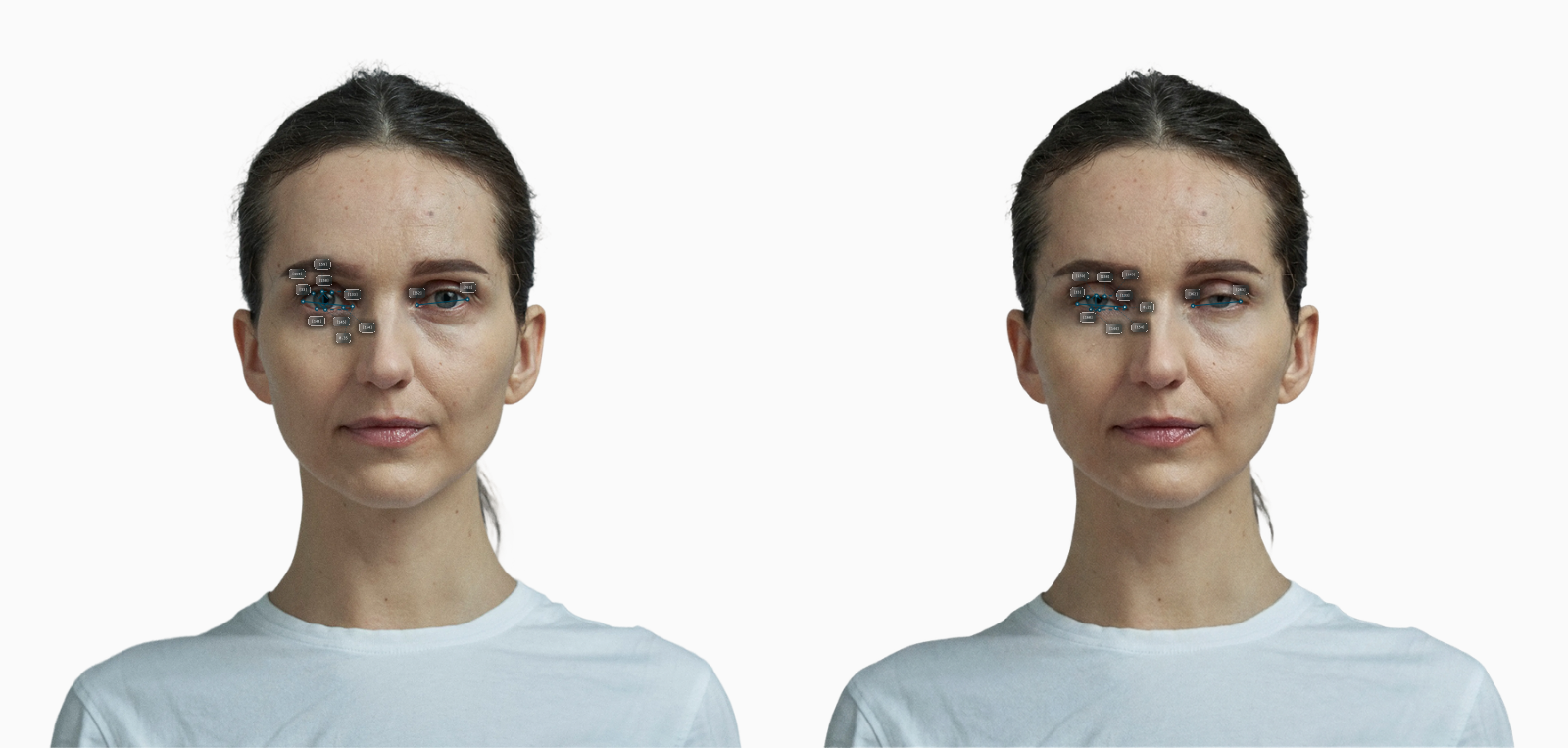 Eye Aspect Ratio (Almondness Ratio) before-and-after comparison on a female frontal portrait