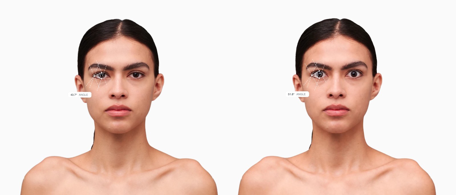 Two copies of the same female front-facing face with the eye aperture angle drawn on each, the right one with wider-open eyes Two copies of the same female front-facing face with the eye aperture angle drawn on each, the right one with wider-open eyes