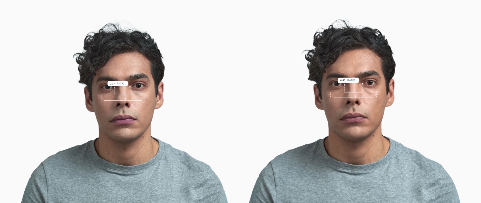 Two copies of the same male front-facing face with the eye spacing ratio drawn on each, the right one with the eyes set further apart Two copies of the same male front-facing face with the eye spacing ratio drawn on each, the right one with the eyes set further apart