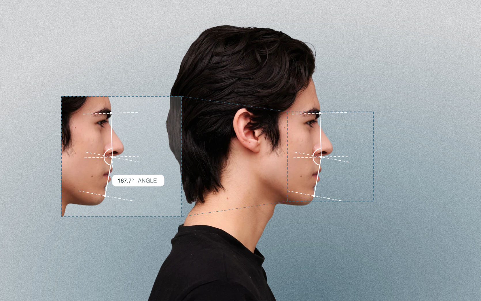 Facial convexity angle measured on a male side-profile portrait Facial convexity angle measured on a male side-profile portrait