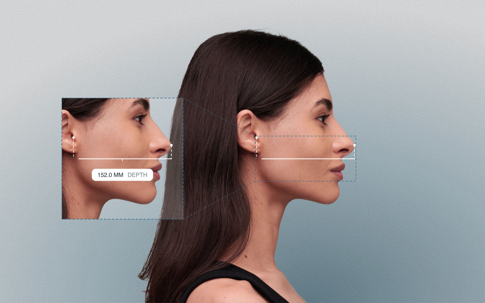 Facial depth measured on a female side-profile portrait Facial depth measured on a female side-profile portrait