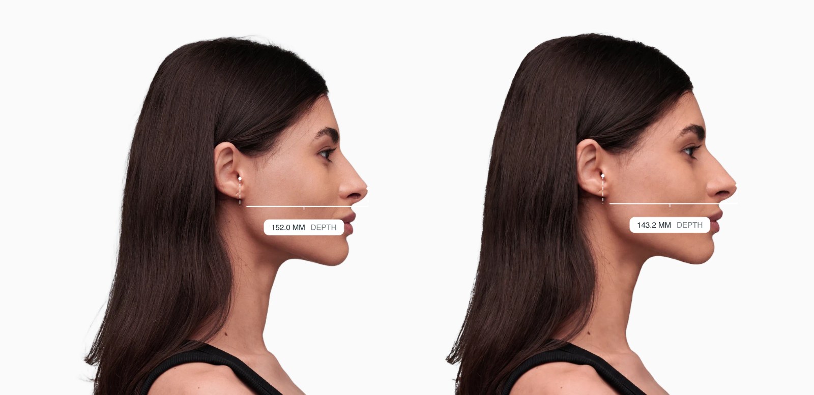 Two copies of the same female side-profile face with the facial depth drawn on each, the right one with a shallower face from front to back Two copies of the same female side-profile face with the facial depth drawn on each, the right one with a shallower face from front to back