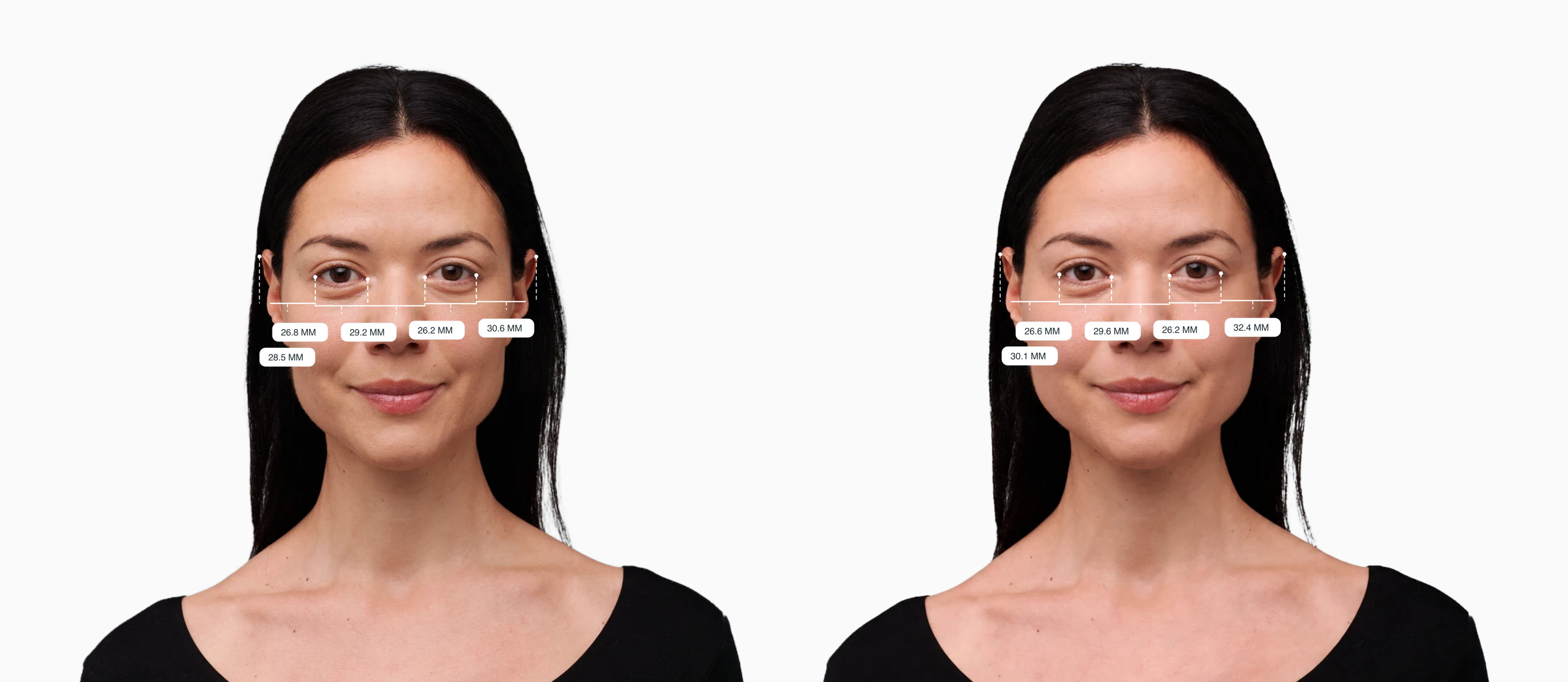 Two copies of the same female front-facing face with the five facial fifths drawn at eye level, the right one with both cheeks built out evenly