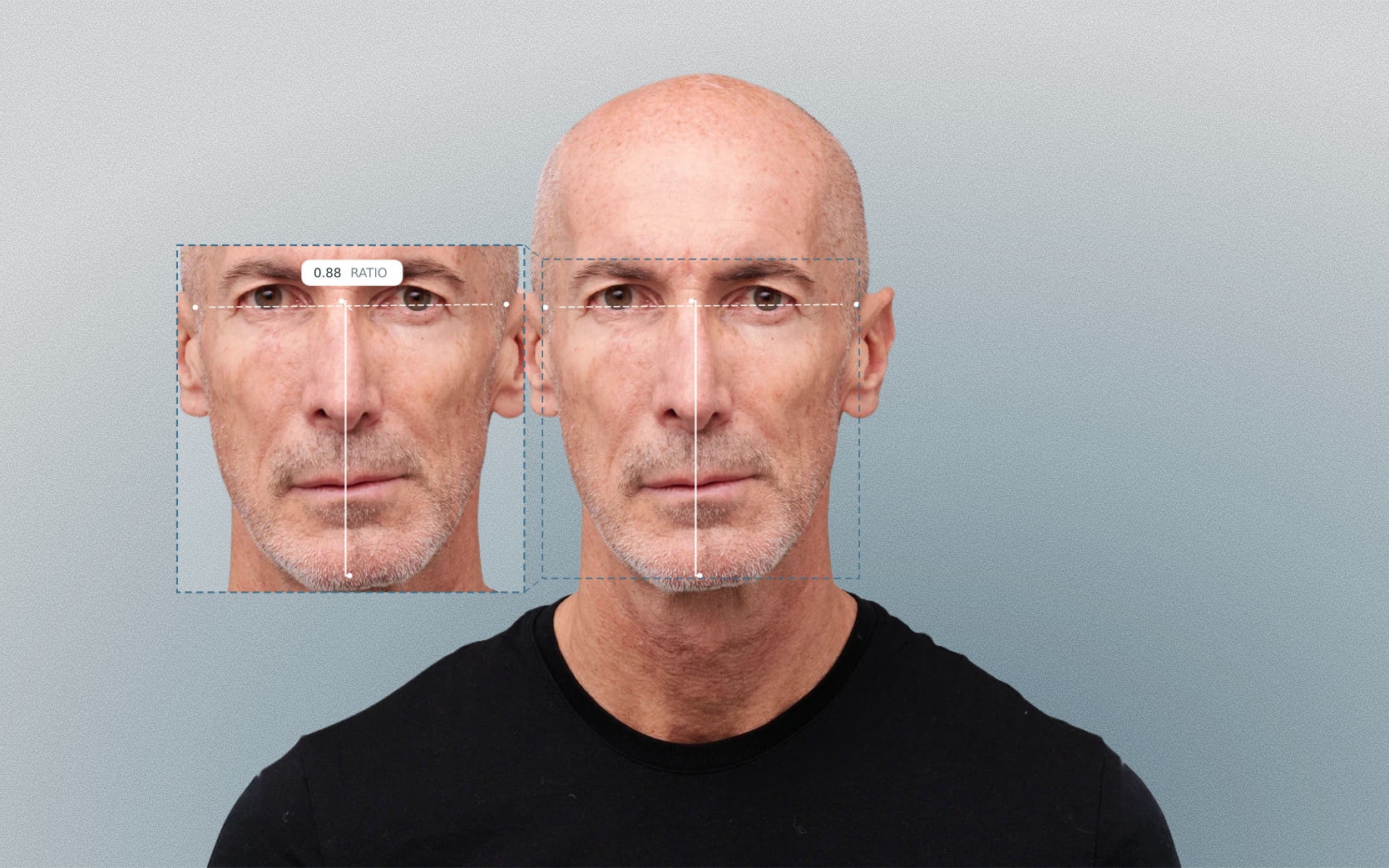 Facial index measured on a male front-facing portrait Facial index measured on a male front-facing portrait