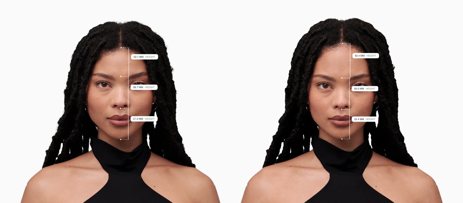 Two copies of the same female front-facing face with the facial thirds drawn on each, the right one with a taller upper face Two copies of the same female front-facing face with the facial thirds drawn on each, the right one with a taller upper face
