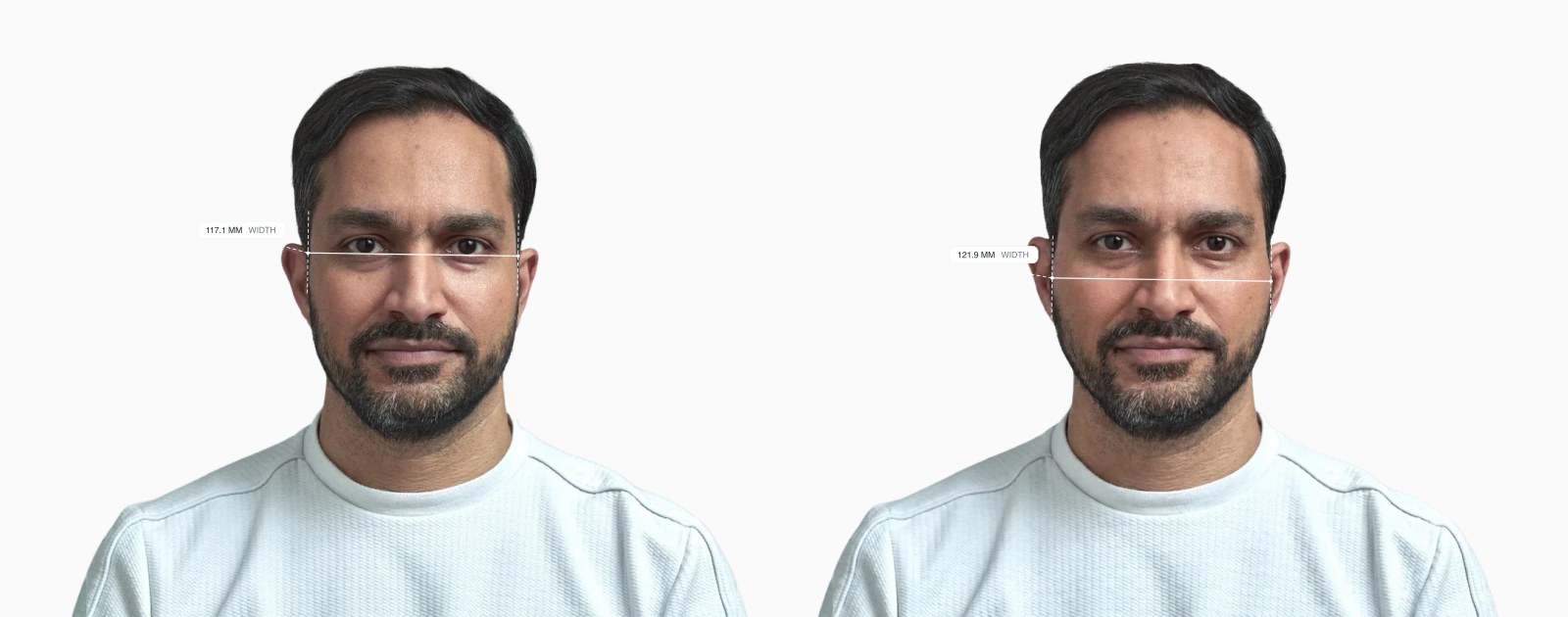 Facial width on a male face before and after, with wider cheekbones on the right Facial width on a male face before and after, with wider cheekbones on the right