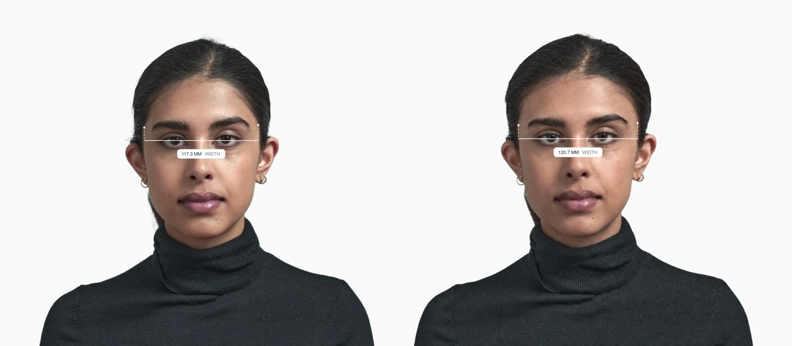 Two copies of the same female front-facing face with the forehead width drawn on each, the right one with a wider forehead Two copies of the same female front-facing face with the forehead width drawn on each, the right one with a wider forehead