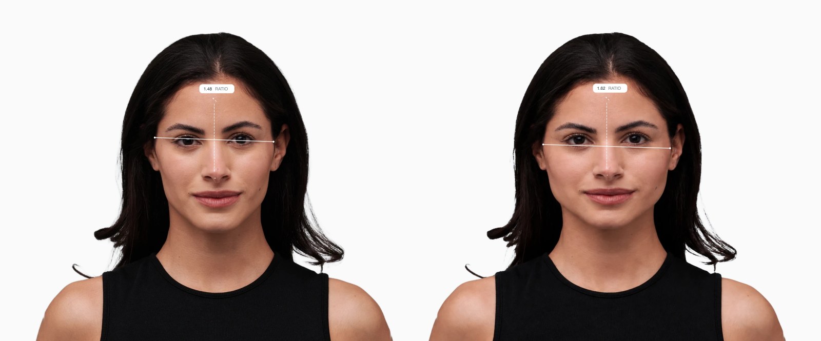 Two copies of the same female front-facing face with the facial width-to-height ratio drawn on each, the right one with a wider midface Two copies of the same female front-facing face with the facial width-to-height ratio drawn on each, the right one with a wider midface