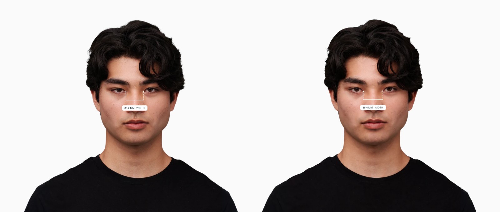 Two copies of the same male front-facing face with the intercanthal width drawn on each, the right one with the inner eye corners set further apart