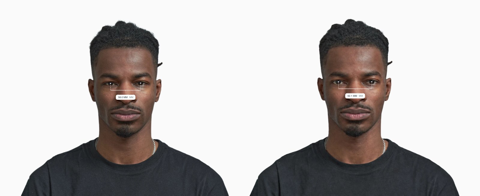 Two copies of the same male front-facing face with the interpupillary distance drawn on each, the right one with the eyes set further apart Two copies of the same male front-facing face with the interpupillary distance drawn on each, the right one with the eyes set further apart