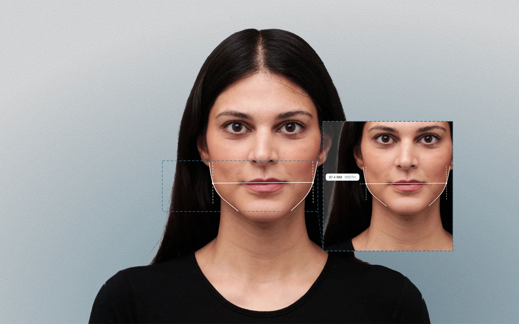 Jaw width measured on a female front-facing portrait Jaw width measured on a female front-facing portrait
