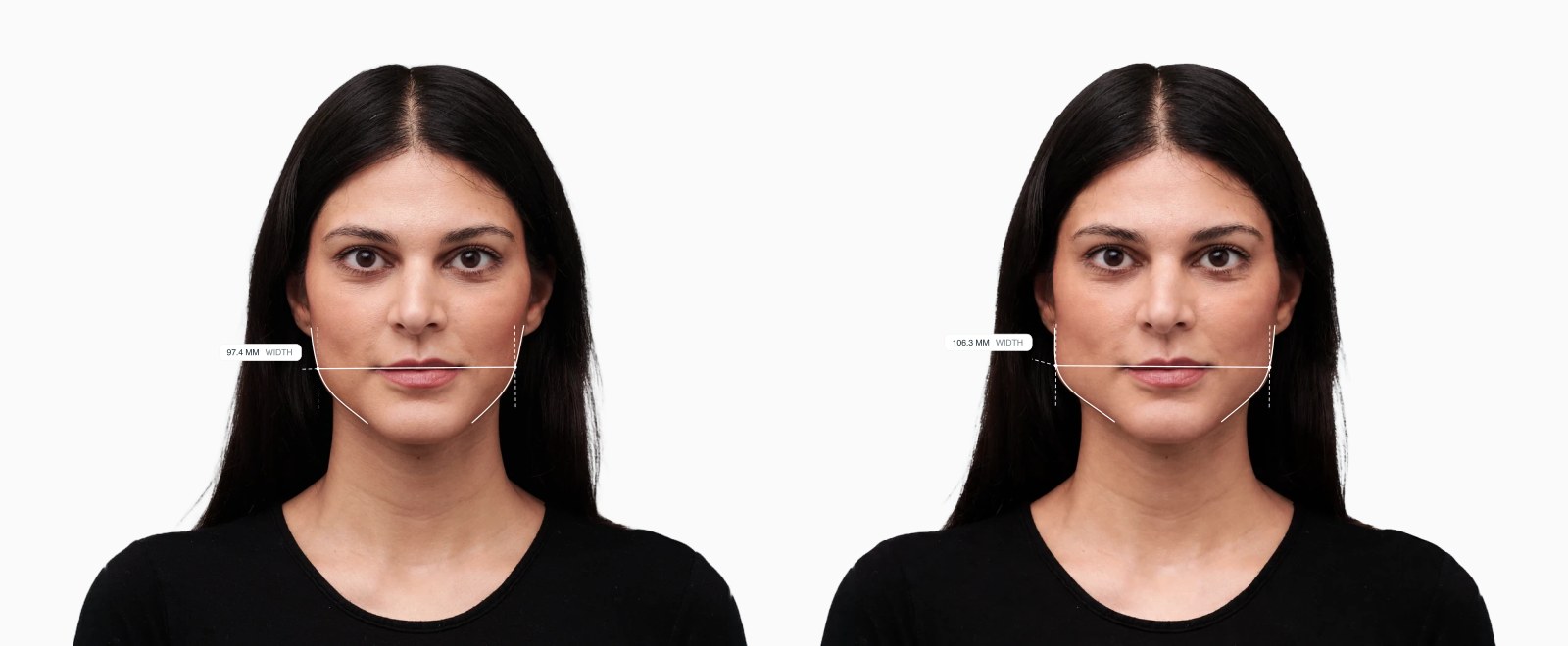 Two copies of the same female front-facing face with the jaw width drawn on each, the right one with a wider jaw Two copies of the same female front-facing face with the jaw width drawn on each, the right one with a wider jaw