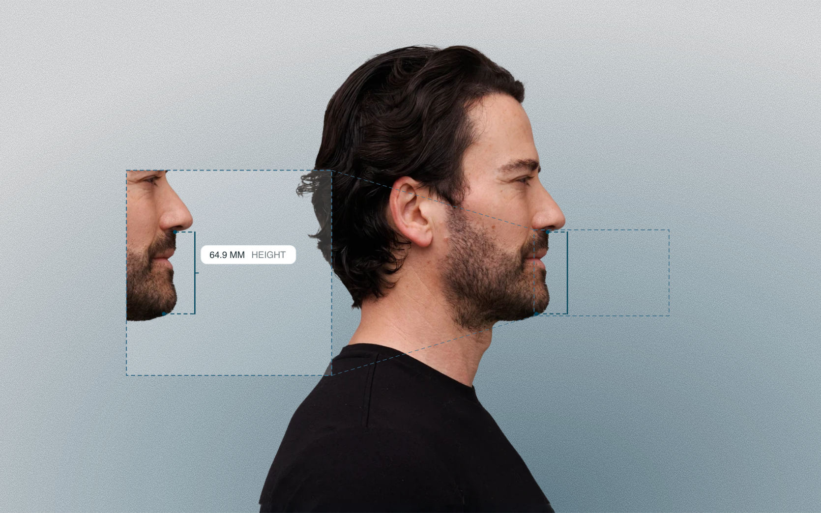 Lower anterior face height measured on a male side-profile portrait Lower anterior face height measured on a male side-profile portrait