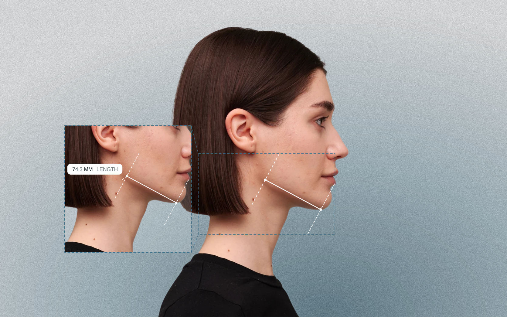 Mandible body length measured on a female side-profile portrait Mandible body length measured on a female side-profile portrait