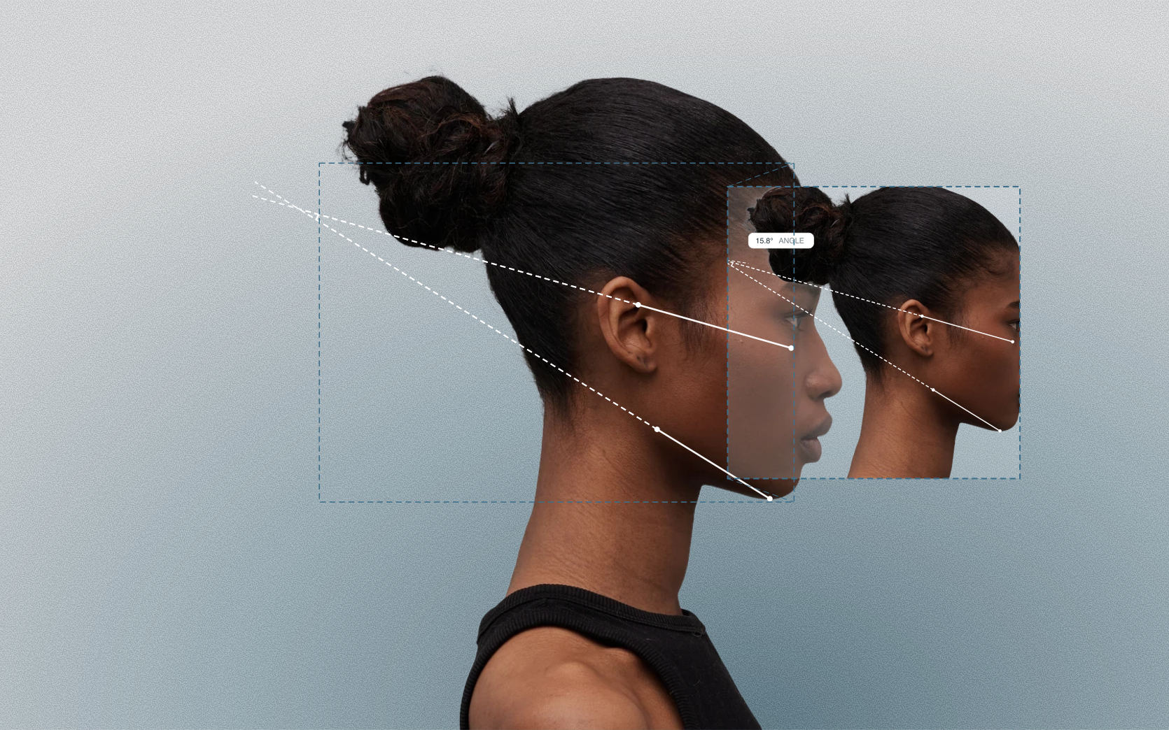 Mandibular plane angle measured on a female side-profile portrait Mandibular plane angle measured on a female side-profile portrait